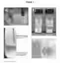 Fig. 02 - Filtering article containing titania nanotubes