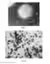 Fig. 09 - METHOD FOR PRODUCING A MICROENCAPSULATE AND CORRESPONDING REACTIVE AMPHIPHILIC COMPOUND, MICROENCAPSULATE AND COMPOSITION