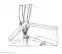 Fig. 01 - Wire bend fixture