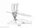 Fig. 07 - Wire bend fixture