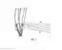 Fig. 09 - Wire bend fixture