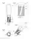 Fig. 03 - METHOD FOR CREATING AN INNER THREAD AS WELL AS A COMBINATION OF A THREAD CUTTER AND A BODY HAVING A CUTOUT
