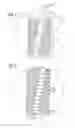 Fig. 04 - METHOD FOR CREATING AN INNER THREAD AS WELL AS A COMBINATION OF A THREAD CUTTER AND A BODY HAVING A CUTOUT