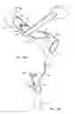 Fig. 06 - BOTTLE SABERING