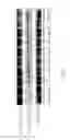 Fig. 06 - Method for preventing or treating heart diseases by using a composition containing an isolated peptide
