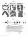 Fig. 09 - Induced regulatory T cell and use thereof