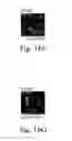 Fig. 49 - Modulation of cardiac stem-progenitor cell differentiation, assays and uses thereof