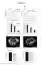Fig. 04 - Methods to screen compounds for regulating USF1 activity and methods and compounds to treat cardiometabolic and lipid pathologies