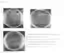 Fig. 07 - TRANSFORMED EUGLENA AND PROCESS FOR PRODUCING SAME