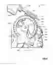 Fig. 07 - Vehicular latch with direct locking of pawl