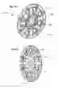 Fig. 45 - Continuously variable transmission