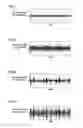 Fig. 07 - Bearing device vibration analysis method, bearing device vibration analyzer, and rolling bearing condition monitoring system