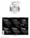 Fig. 04 - Optogenetic probes for measuring membrane potential