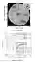 Fig. 04 - Photo sensor for use as a radiation detector and power supply and method for making and using the device