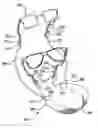 Fig. 01 - Eyeglass retention device