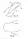 Fig. 06 - Eyeglass retention device