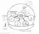 Fig. 01 - Manufacturing process of an accommodating soft contact lens
