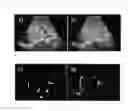 Fig. 01 - Eliminating motion effects in medical images caused by physiological function