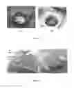 Fig. 10 - Post-CMOS processing and 3D integration based on dry-film lithography