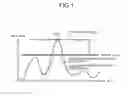 Fig. 02 - Peak suppression apparatus