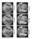 Fig. 19 - ANAMORPHIC STRETCH IMAGE COMPRESSION