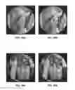 Fig. 27 - ANAMORPHIC STRETCH IMAGE COMPRESSION