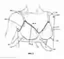 Fig. 02 - Upper and lower torso garments having an improved band