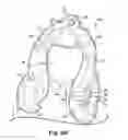 Fig. 06 - MASK WITH INTEGRAL HANDLE