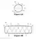 Fig. 07 - Strand-wound bladder