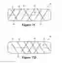 Fig. 09 - Strand-wound bladder