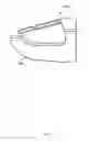Fig. 06 - FINGER-MOUNTED FILING DEVICE