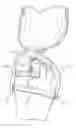Fig. 01 - Wearable Pedicure Protection Device