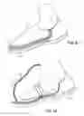 Fig. 06 - Wearable Pedicure Protection Device