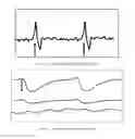Fig. 02 - PERSONAL HEALTH DATA COLLECTION