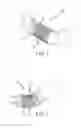 Fig. 02 - Flexible high-density mapping catheter tips and flexible ablation catheter tips with onboard high-density mapping electrodes