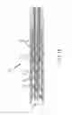 Fig. 09 - Flexible high-density mapping catheter tips and flexible ablation catheter tips with onboard high-density mapping electrodes