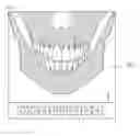 Fig. 02 - Displaying 3D image with a plurality of surface images at depths of interest