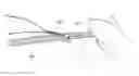 Fig. 01 - Methods of making reinforced soft tissue grafts with suture loop/needle constructs