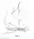 Fig. 03 - Methods of making reinforced soft tissue grafts with suture loop/needle constructs