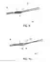 Fig. 07 - Methods of making reinforced soft tissue grafts with suture loop/needle constructs