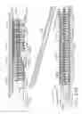 Fig. 138 - Staple cartridge comprising staples positioned within a compressible portion thereof