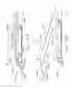 Fig. 191 - Staple cartridge comprising staples positioned within a compressible portion thereof