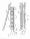Fig. 210 - Staple cartridge comprising staples positioned within a compressible portion thereof