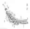 Fig. 98 - Staple cartridge comprising staples positioned within a compressible portion thereof
