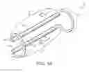 Fig. 02 - Appendage clamp deployment assist device