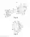 Fig. 09 - Customized patient-specific revision surgical instruments and method