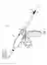 Fig. 02 - Surgical instrument with variable tissue compression