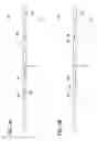 Fig. 03 - Cleaning device for catheter and catheter including the same