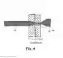 Fig. 08 - Surgical articles and methods for treating pelvic conditions