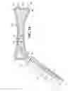 Fig. 07 - Bone fixation with a pin and a collar